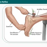 Achilles Tendon Reflex