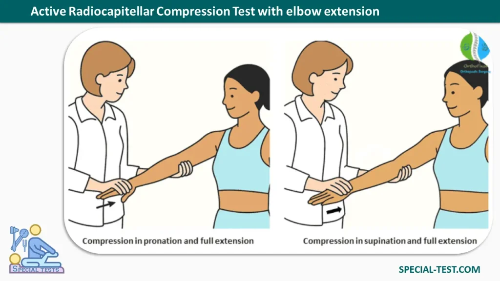 Active Radiocapitellar Compression Test with elbow extension