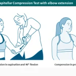 Active Radiocapitellar Compression Test with elbow flexion