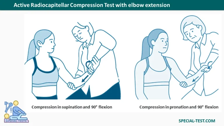 Active Radiocapitellar Compression Test with elbow flexion