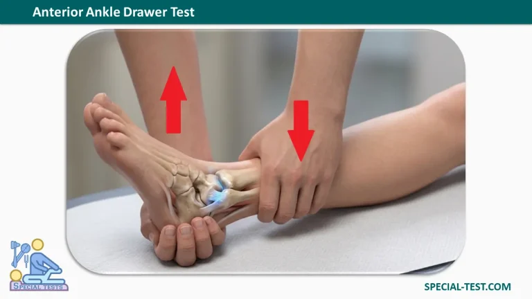 Anterior Ankle Drawer Test