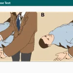 Anterior Release Test