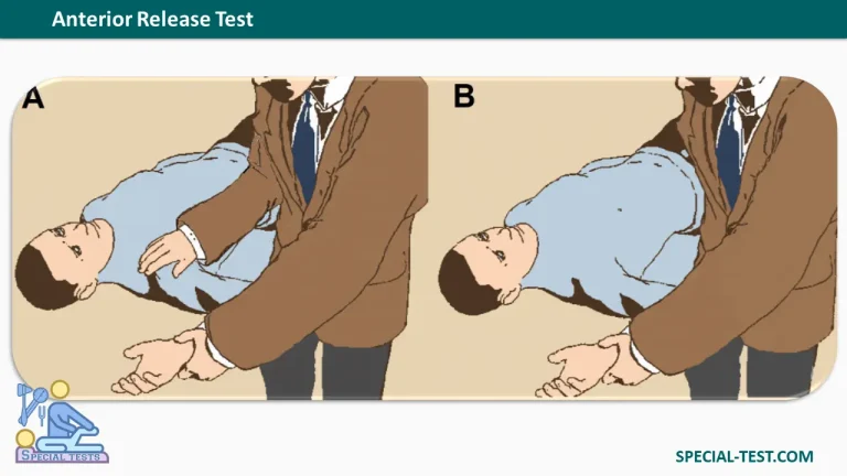 Anterior Release Test