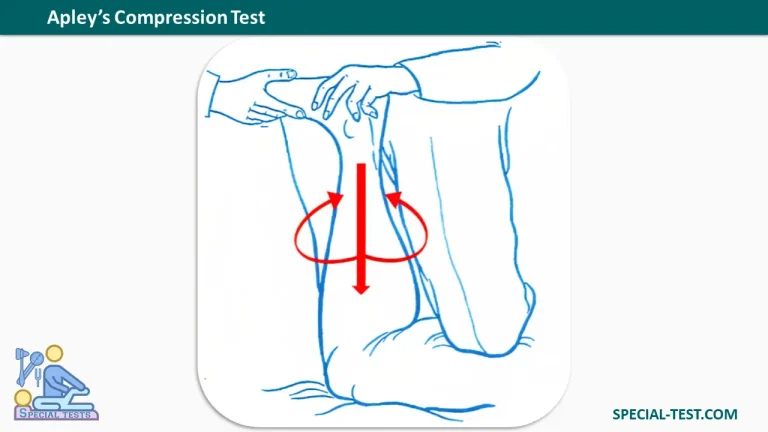 Apleys Compression Test