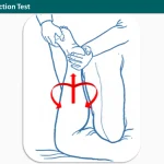 Apleys Distraction Test