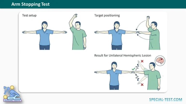 Arm Stopping Test