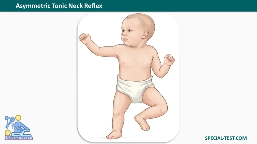 Tonic Neck Reflexes 2 Asymmetric Tonic Neck Reflex