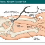 Auscultatory Patellar Pubic Percussion Test
