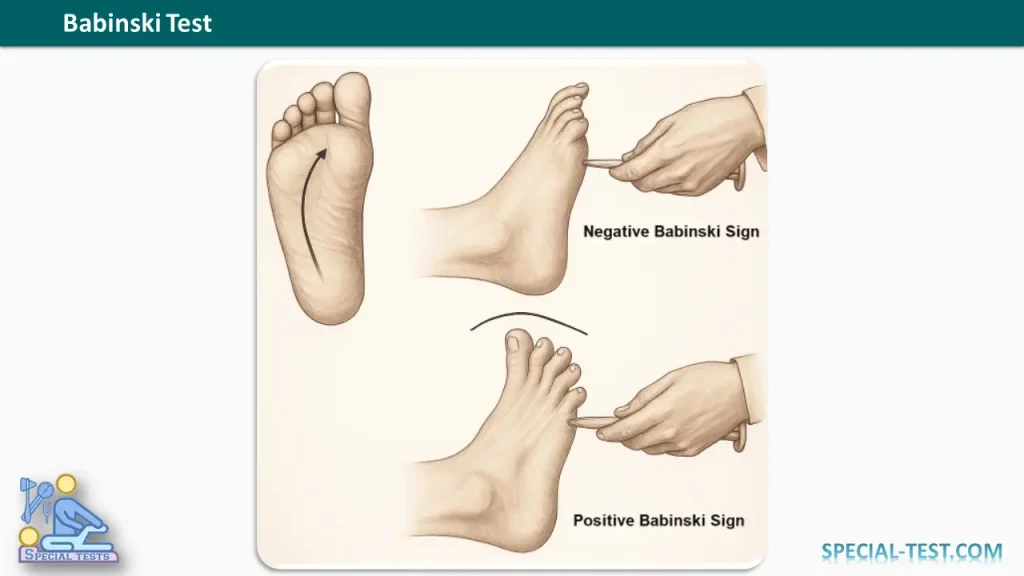 Babinski Test