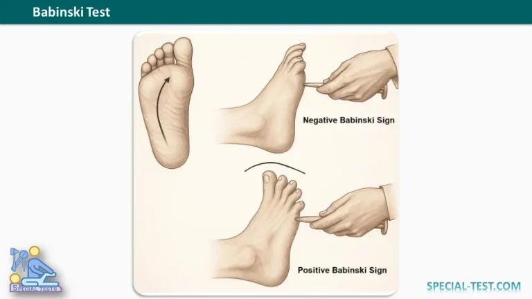 Babinski Test