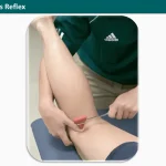 Biceps Femoris Reflex
