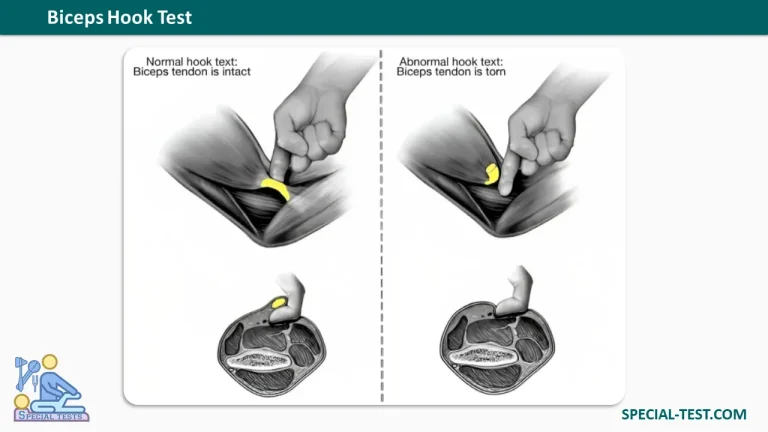 Biceps Hook Test