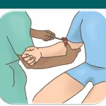 Biceps Reflex