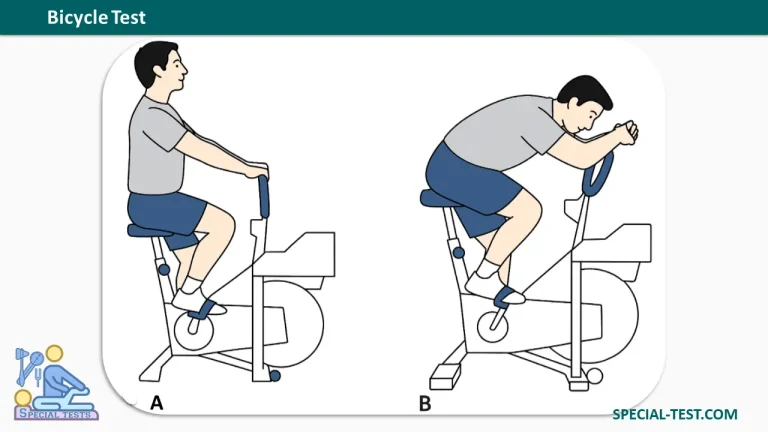 Bicycle Test