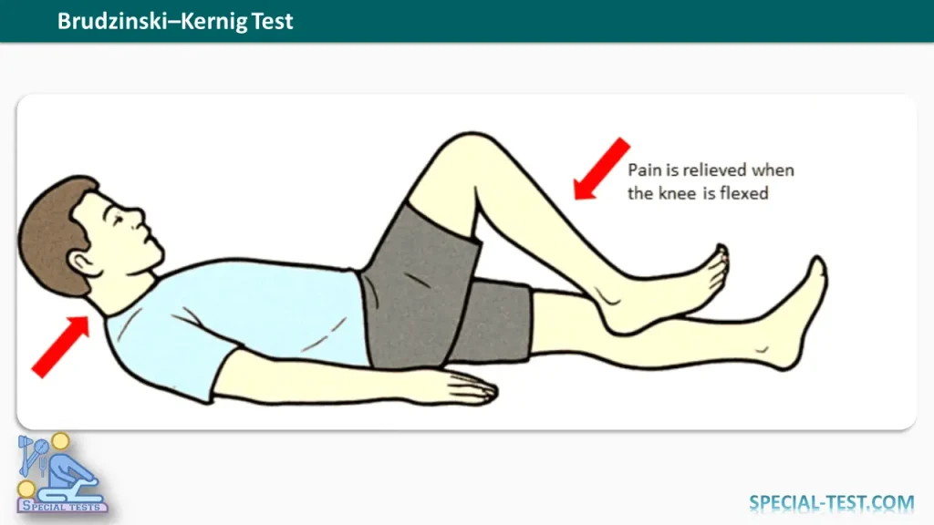 Brudzinski–Kernig Test