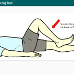 Brudzinski–Kernig Test