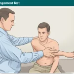 Coracoid Impingement Test