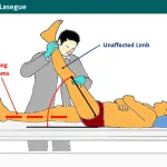 Crossed Over Lasegue Test