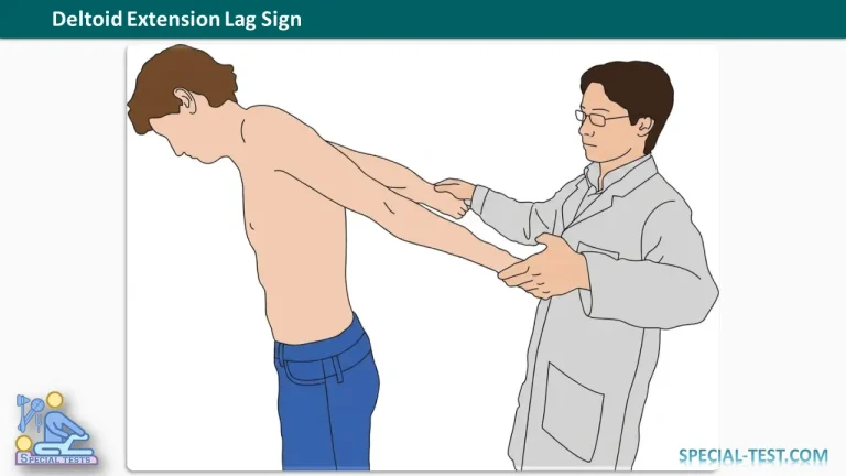 Deltoid Extension Lag Sign