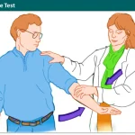 Deltoid Muscle test