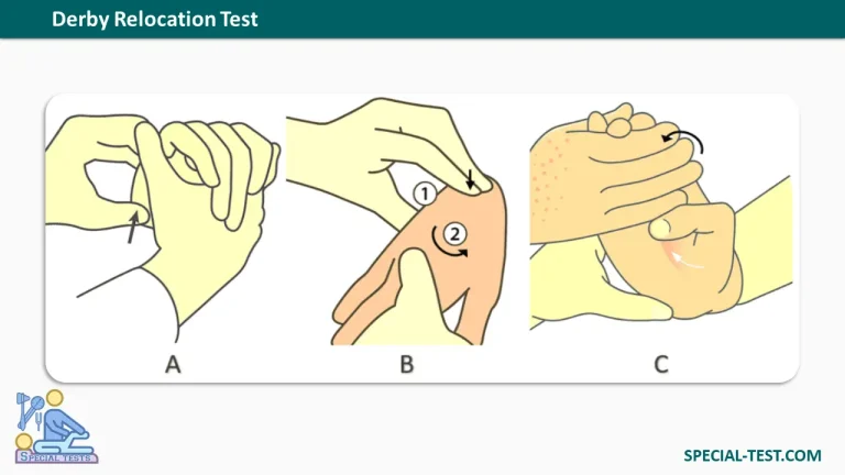 Derby Relocation Test