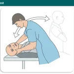 Dix Hallpike Test