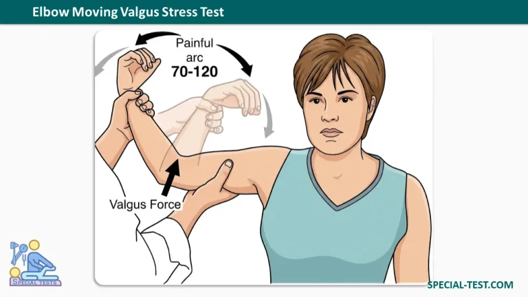 Elbow Moving Valgus Stress Test
