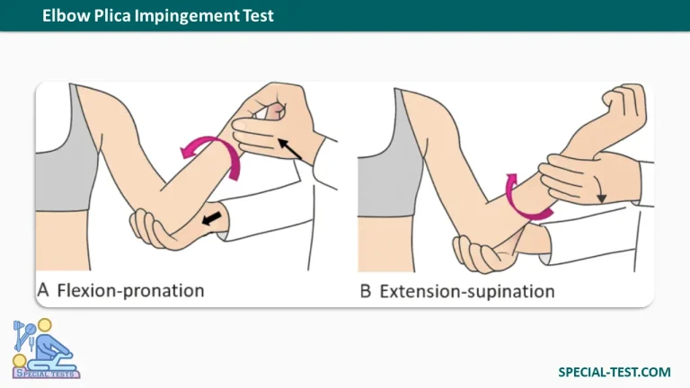 Elbow Plica Impingement Test