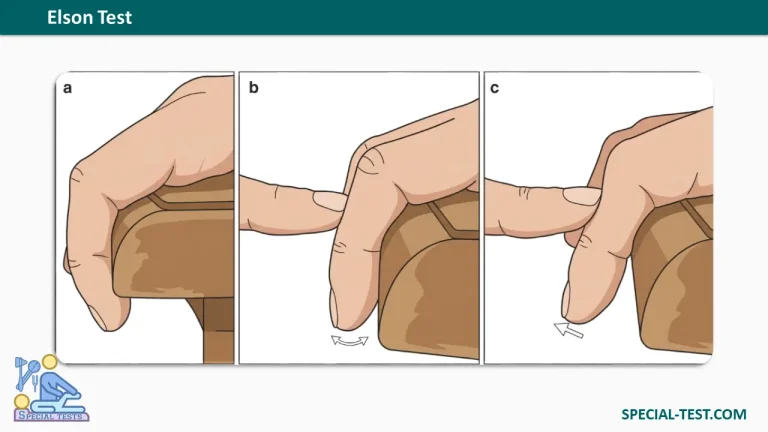 Elson test