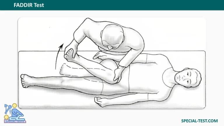 FADDIR test Flexion Adduction internal Rotation test