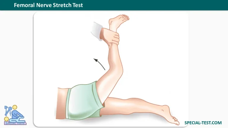 Femoral Nerve Stretch Test