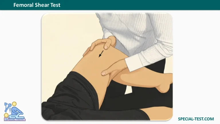 Femoral Shear Test