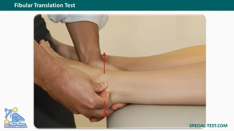 Fibular Translation Test
