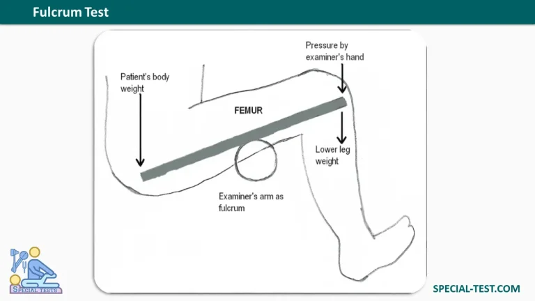 Fulcrum Test