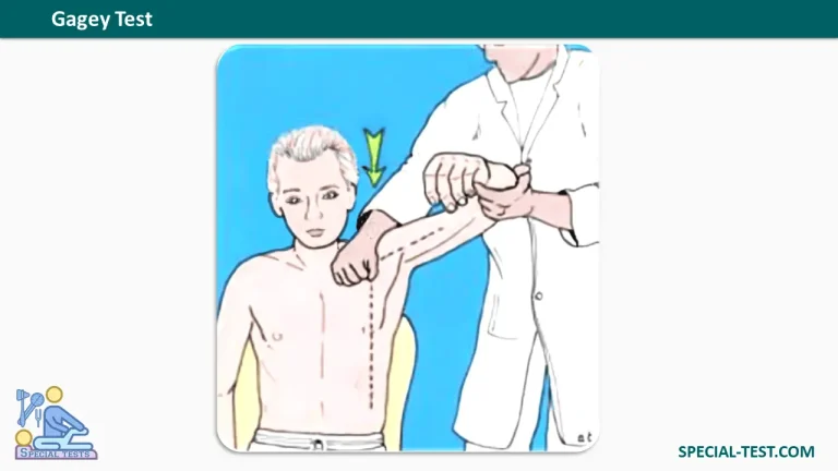 Gagey Test
