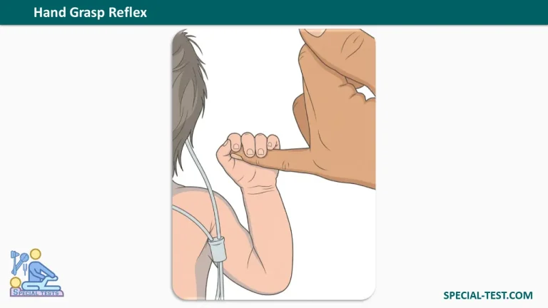 Hand Grasp Reflex