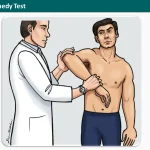 Hawkins-Kennedy Test