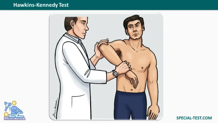 Hawkins Kennedy test