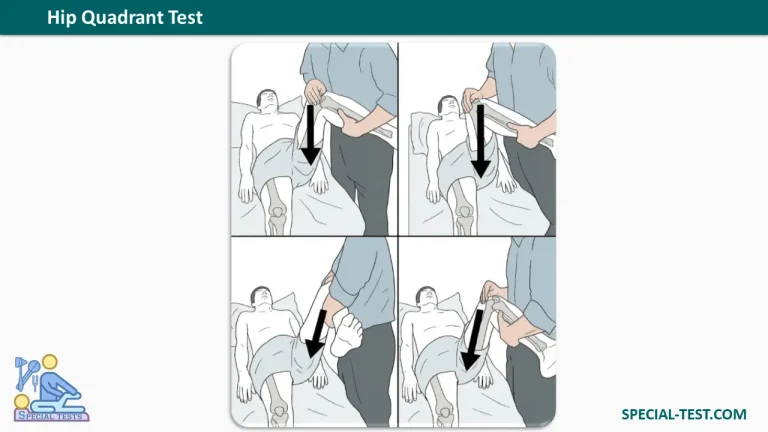 Hip Quadrant Test