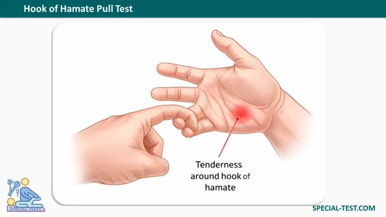 Hook of Hamate Pull Test