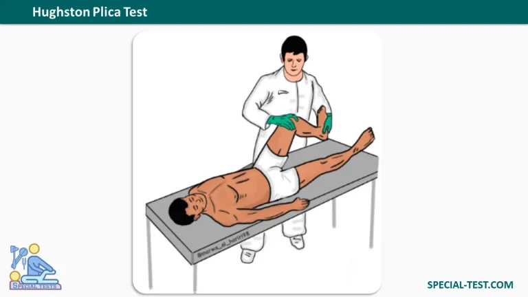 Hughston Plica Test