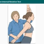 Hyperextension Internal Rotation Test
