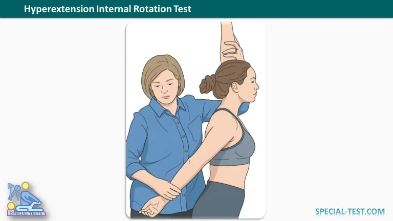Hyperextension Internal Rotation Test