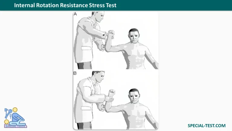 Internal Rotation Resistance Stress Test