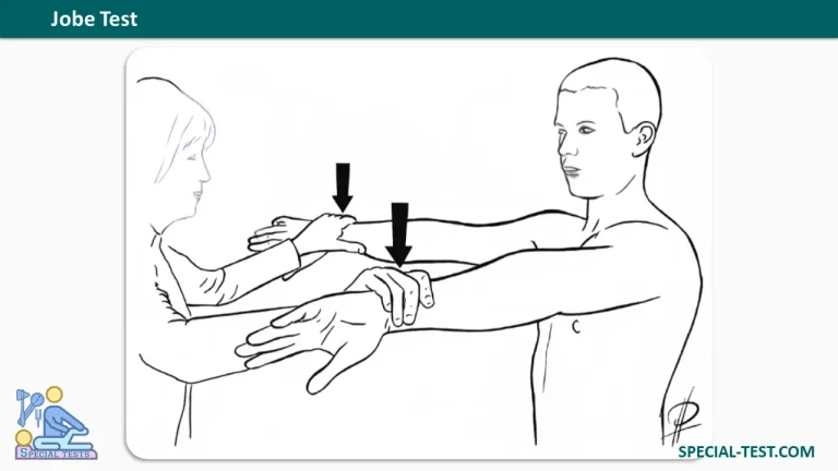 Jobe Test