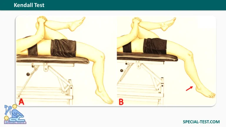 Kendall Test