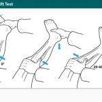 Knee Pivot Shift Test