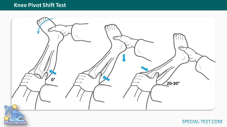 Knee Pivot Shift Test