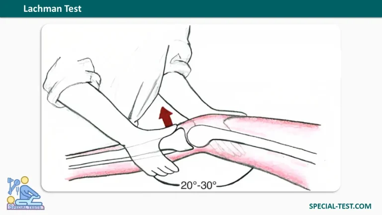 Lachman Test