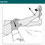 Lateral McMurray Test